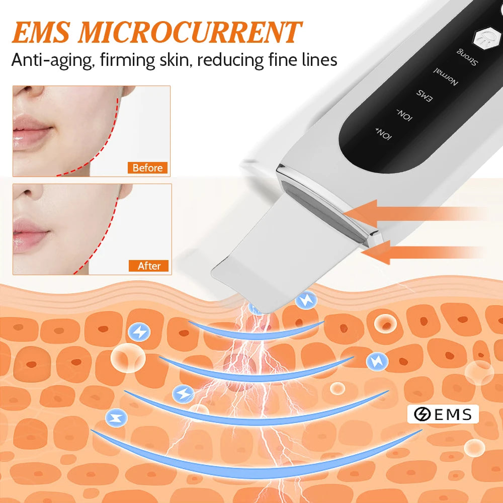 Ultrasonic Skin Scrubber Face Pore Cleaner Deep Cleansing Tool with 4 Modes Peeling Blackhead Remover for Facial Skincare