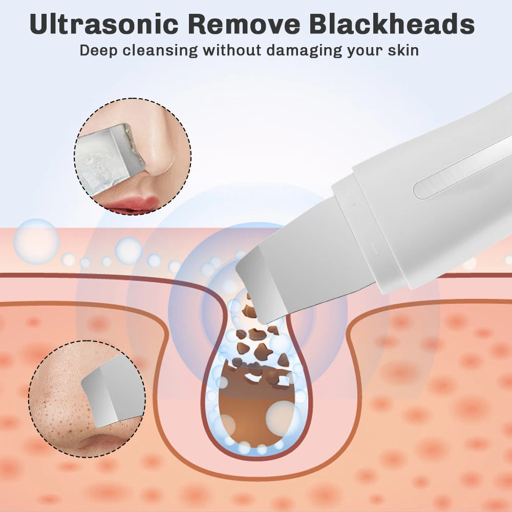 Ultrasonic Skin Scrubber Face Pore Cleaner Deep Cleansing Tool with 4 Modes Peeling Blackhead Remover for Facial Skincare