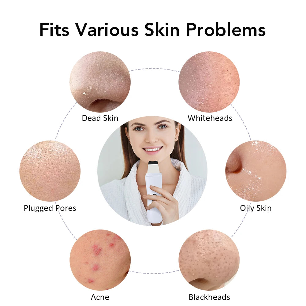 Ultrasonic Skin Scrubber Face Pore Cleaner Deep Cleansing Tool with 4 Modes Peeling Blackhead Remover for Facial Skincare